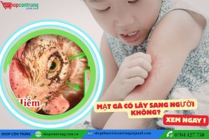 Mạt gà có lây sang người không?